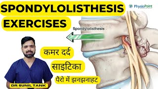 Spondylolisthesis Exercises  Spondylolisthesis physiotherapy treatment  L4L5 L5S1  Sciatica [upl. by Biddy]