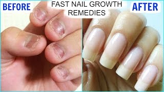 How To GROW Long Strong Nails Fast At Home  SuperPrincessjo [upl. by Kumler]