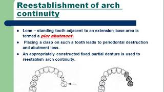 Fall 2020  Prosthesis 7  Lec 3  Mouth preparation Part 2 [upl. by Kala]