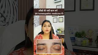 आखों पर जमा फैट हटाए आसानी से  Xanthelasma Treatment Easy And Simple Treatment [upl. by Lear]