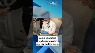 prostodoncia dentista protesisdental protesisdentales protesista [upl. by Bocoj941]