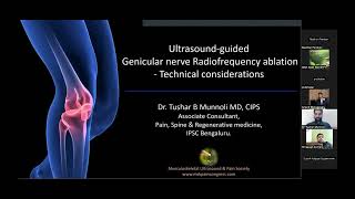 Ultrasound guided Genicular nerve interventions  New Landmarks Technical Considerations [upl. by Duma]