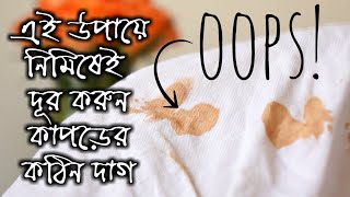 এই সহজ উপায়ে দূর করুন কাপড়ের কঠিন দাগ  how to remove clothes stain  kapore dag tolar upay [upl. by Phoebe]