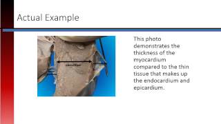 Phlebotomy Lesson 27 Layers of the Heart [upl. by Ihc]