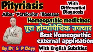 Pityriasis  सेहुआ  सफेद दाग  फीका दाग  Best Homeopathic Medicines [upl. by Imotas]