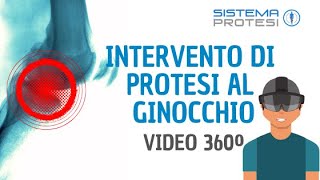 🔴 INTERVENTO PROTESI del GINOCCHIO ▷▷ VIDEO A 360º [upl. by Faubion]