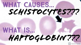 What causes Schistocytes What is Haptoglobin Hematology Hematopathology Basics [upl. by Adeys947]