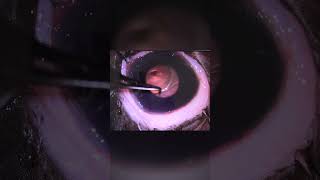 Deep Corneal Ulcer shorts veterinaryophthalmology [upl. by Ennaus930]