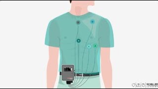 SCHILLER lenregistrement ambulatoire de lECG  Holter ECG [upl. by Nyladnor]