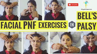 FACIAL PNF EXERCISES IN BELLS PALSY [upl. by Norri]