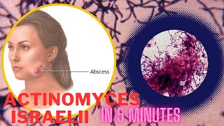 actinomyces microbiology lecture actinomyces israelii Easy Microbiology [upl. by Asyar]