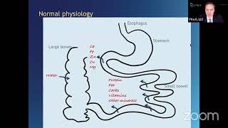 Nutritional Implications of Duodenal Switch Surgery [upl. by Mcneil]