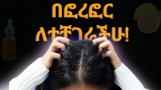 የፎረፎር ህክምና በቤት ውስጥTreat dandruff at home [upl. by Xer139]