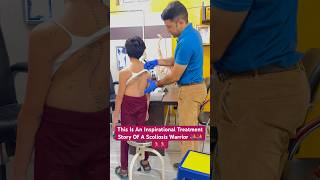 Rare Scoliosis Deformity Treatment By DrRavi scoliosis kyphosis chiropractic chiro shorts reel [upl. by Alaunnoif]