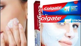 Best Toothpaste Beauty Hacks for Skin Problems  Beauty Benefits of Toothpaste youtube trending [upl. by Hubert613]