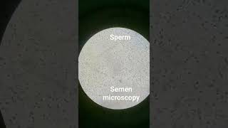 sperm under microscope [upl. by Zoha]