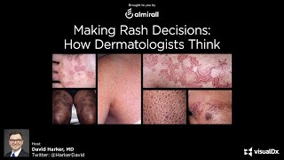 Making Rash Decisions How Dermatologists Think  Dr David Harker [upl. by Inaliak]