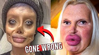 7 Times Plastic Surgery Went Horribly Wrong  Biggest Plastic Surgery Fails [upl. by Myrna]