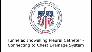 Tunneled Indwelling Pleural Catheter  Connecting to Chest Drainage System [upl. by Anirdnajela]