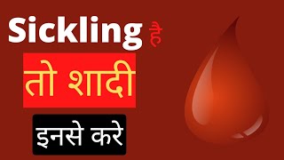 Sickling है तो शादी इनसे करे।Sickle cell anemia [upl. by Dnalyag]