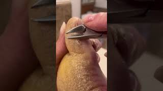 ASMR Toe Maintenance Clipping with Hyperkeratosis EPPK foot callus Keratoderma  May 23 2023 [upl. by Nodle539]