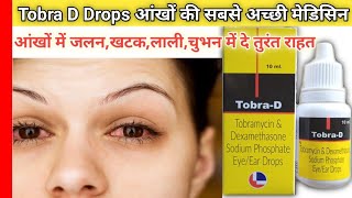 ✅Tobra D Drops आंखों में जलन  खटक  लाली  चुभन  एलर्जी  इन सब में दे तुरंत राहत side effects [upl. by Dranoc]