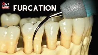 FURCATION The anatomic area of a multirooted tooth where the roots diverge [upl. by Timmons]