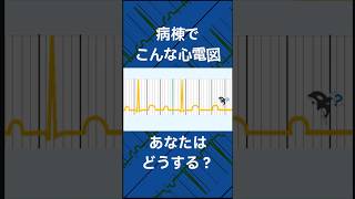 こんなモニター心電図、あなたはどうする？part10 心電図検定、看護師、心電図 [upl. by Cohette]