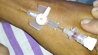 peripheral iv insertion correct Angle iv cannulation [upl. by Akitnahs]