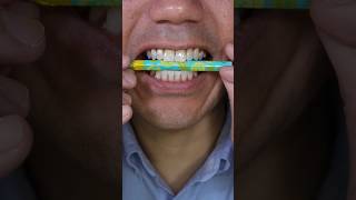 Nobel Super Soda Candy ASMR satisfying food candy shorts [upl. by Lehcar]