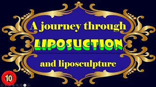 A journey through liposuction and liposculpture Part 1010 and the last [upl. by Adnolrehs]