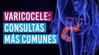 Dudas más comunes sobre el varicocele en consulta 👨‍⚕️ [upl. by Stern170]