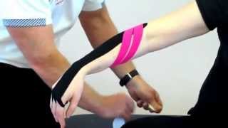 How to apply Kinesiology tape for Tennis Elbow  lateral epicondilitis [upl. by Ydnarb345]