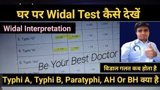 Widal Test In Hindi  विडाल टेस्ट  Widal Test Report Reading In Hindi  Typhoid Fever Test [upl. by Coralyn781]