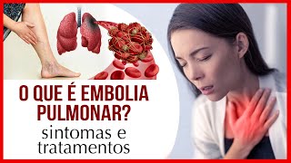 O que é Embolia Pulmonar Sintomas e Tratamentos [upl. by Veta]