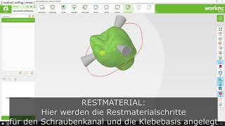 WorkNC Dental 2017 Berechnung Abutment auf Klebebasis Restmaterial [upl. by Ynnor]