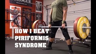 How I Beat Piriformis Syndrome  False Sciatica [upl. by Bathsheba]