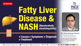 Fatty Liver Disease amp NASH Nonalcoholic Steatohepatitis  Causes Symptoms Diagnosis amp Treatment [upl. by Eissehc]