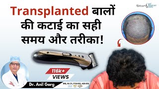 Can I Trim My Hair After Hair Transplant  Transplanted बालों की कटाई का सही समय और तरीका [upl. by Oigres]