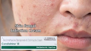 How to use Broad Spectrum Anti  Fungal  Skin Fungal cream Clotrimazole  Pharma Medicine [upl. by Gavriella619]