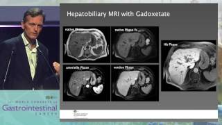 Opening Lecture Pitfalls in imaging for liver tumors [upl. by Bernita]