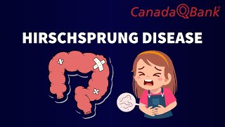 Hirschsprung Disease [upl. by Asecnarf]