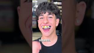 Protector bucal con Brackets dientes dentista tips parati viral fyp shorts shortvideo fypシ [upl. by Sheets]