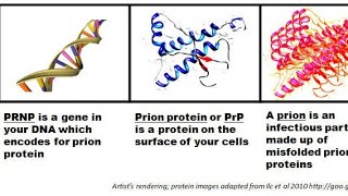 Prions  Prions Disease  Transmissible Spongiform Encephalopathies Diagnosis and treatment [upl. by Somar875]