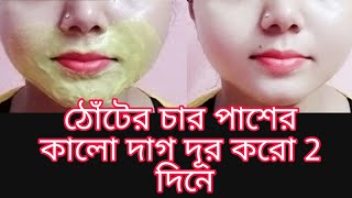 Pigmentation বা ঠোঁটের চার পাশের কালো দাগ দূর করার একটা 100 কার্যকরী উপায়  Beauty Highlighting [upl. by Russel734]