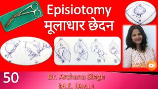 50 Episiotomy  मूलाधार छेदन [upl. by Eixam]