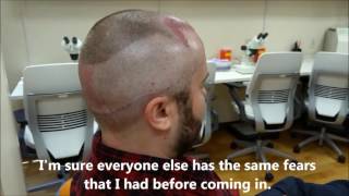 Patient IMMEDIATELY following an ARTAS robotic hair transplant talks about what it was like [upl. by Leontyne908]