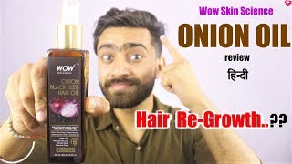 Wow ONION OIL review  Onion Oil benefits Hair Growth How to use  QualityMantra [upl. by Apostles867]