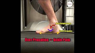 Over pronation can cause foot and ankle pain [upl. by Atnim]