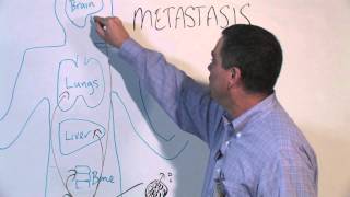 How Cancer Spreads Metastasis  Michael Henry PhD [upl. by Ariella]